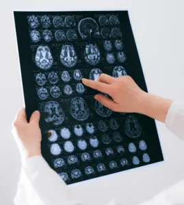 Stroke Risk Indicator
